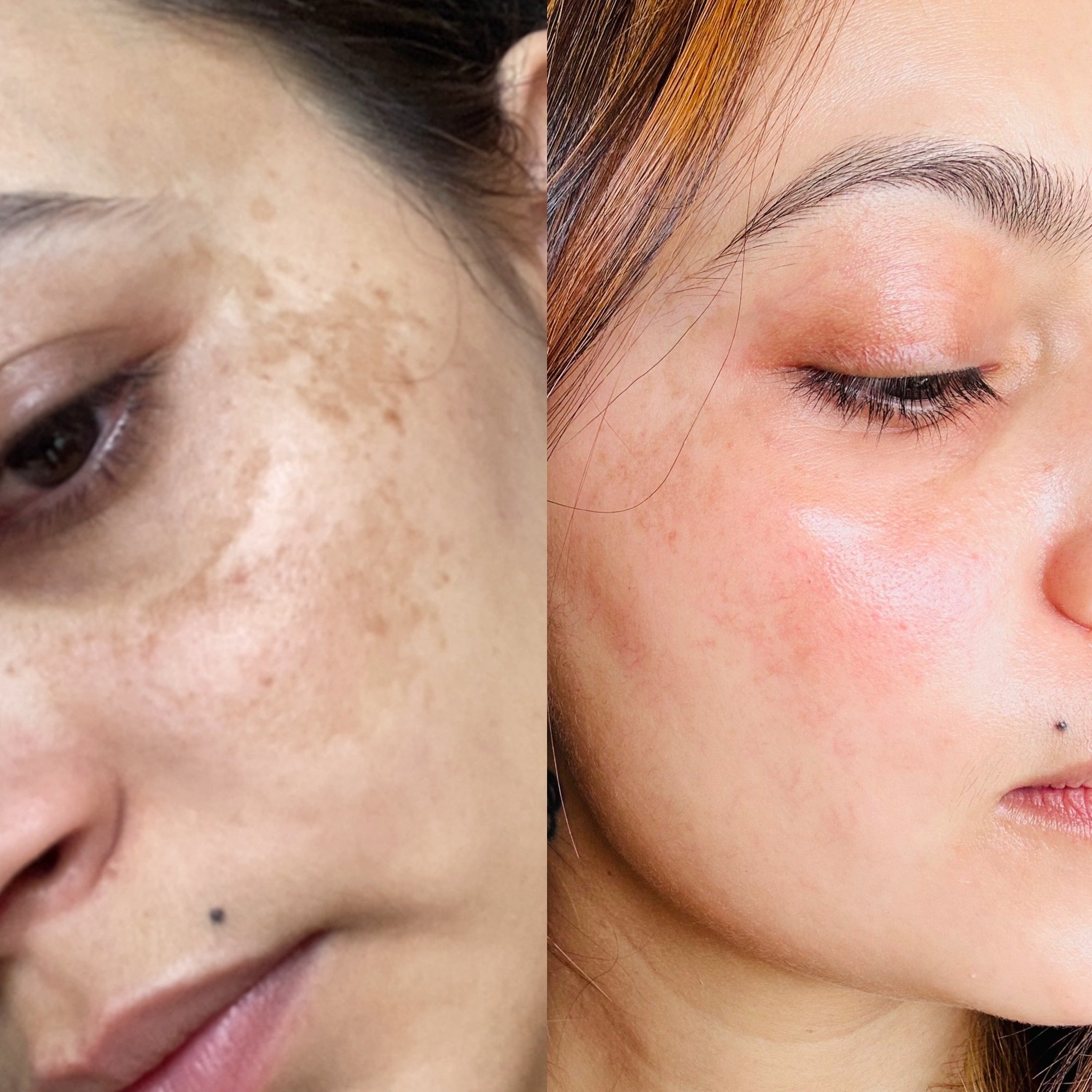 Hybrid Sunscreen Gel SPF 50 | Niacinamide + Hyaluronic Acid | Skinmush