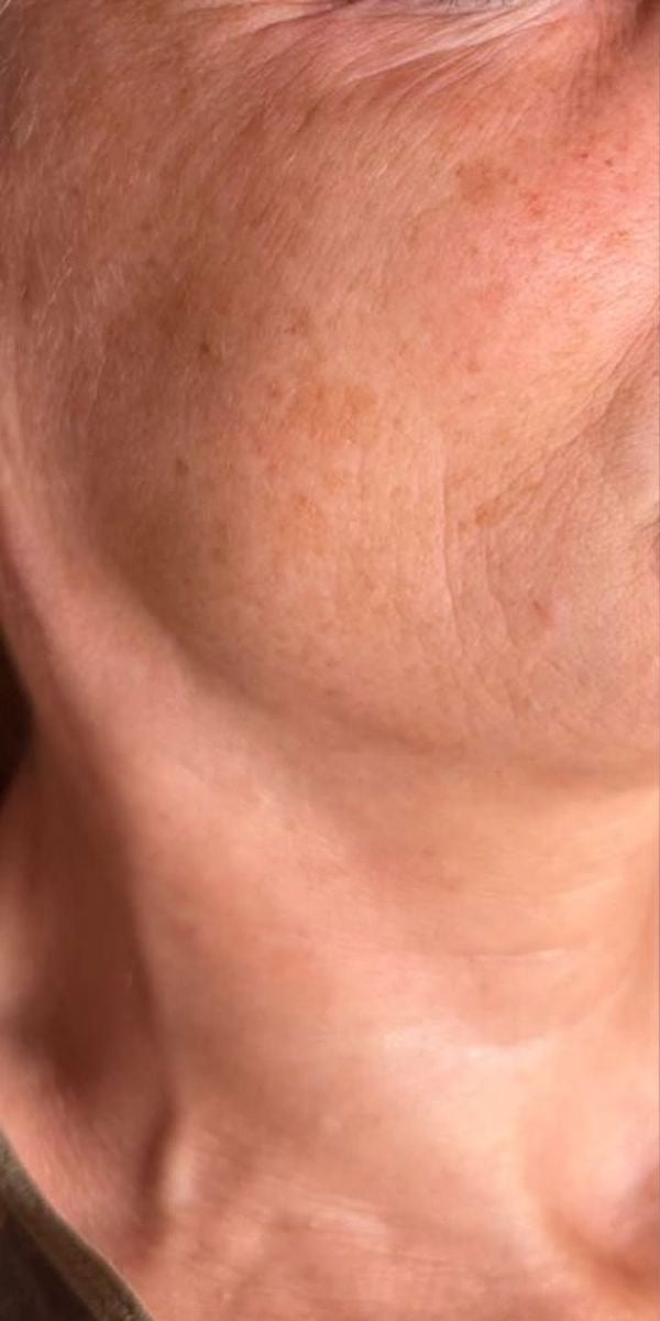 Before β Skin Brightening Combo Face Care
