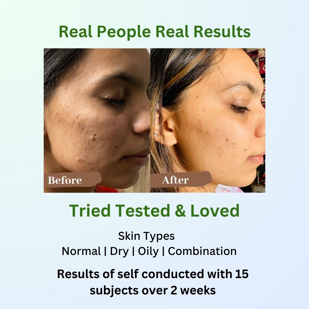 Orange Mint Acne Reversal & Dark Spot Face Wash 100 ml