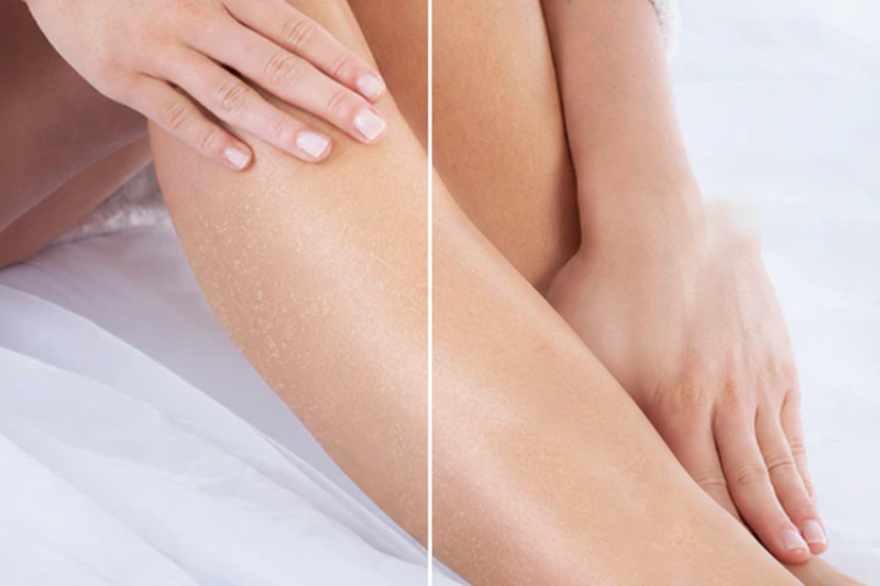 Simple Before After Legs