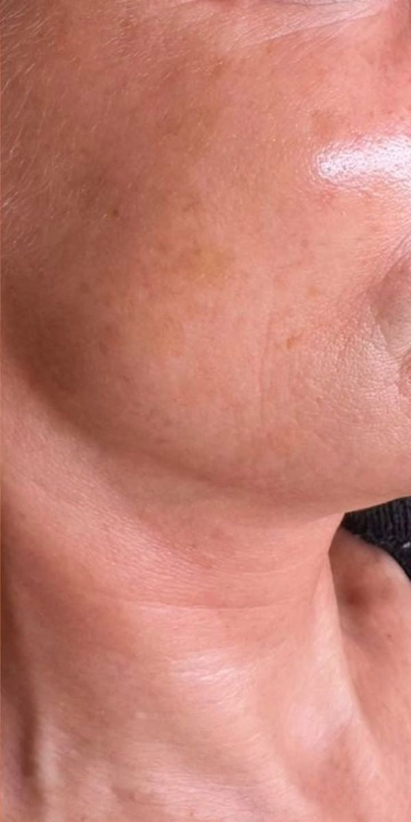 After — Skin Brightening Combo Face Care